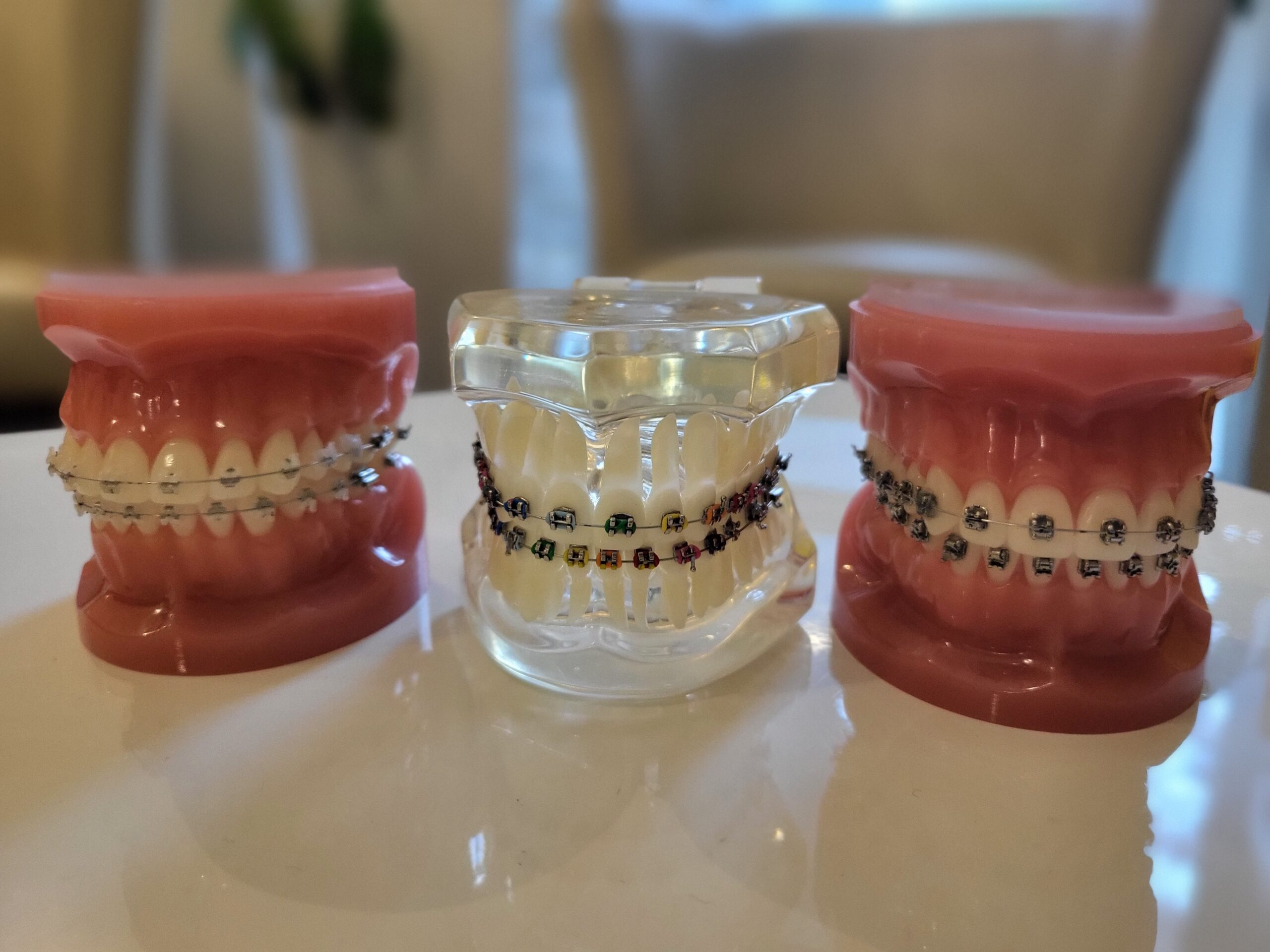 Aparat ortodontyczny cena