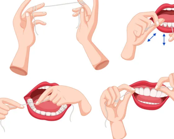 Nitkowanie zębów – dlaczego warto stosować i jak właściwie używać nici dentystycznej?